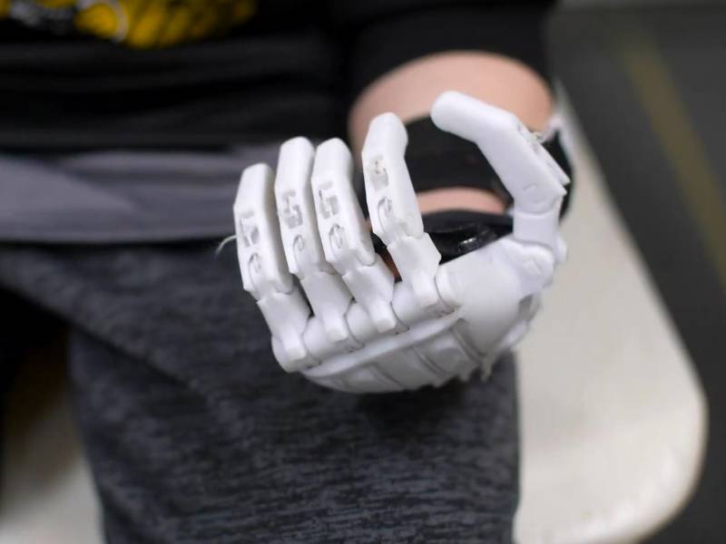 Robotic hand