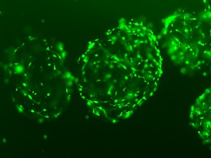 tumor cells
