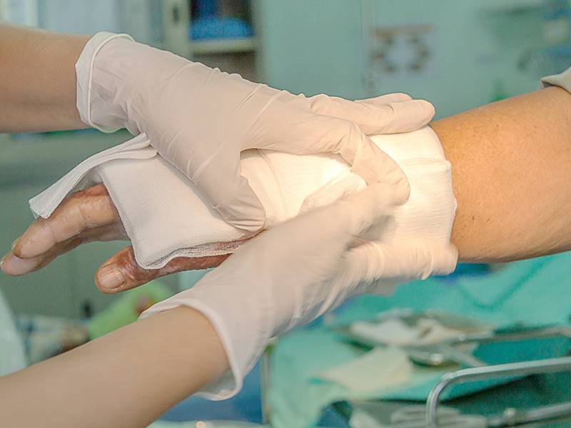 Stock photo of a wound being treated