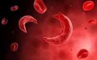 placeholder sickle cell study fall 2019