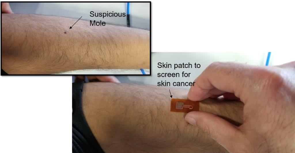 Skin cancer research