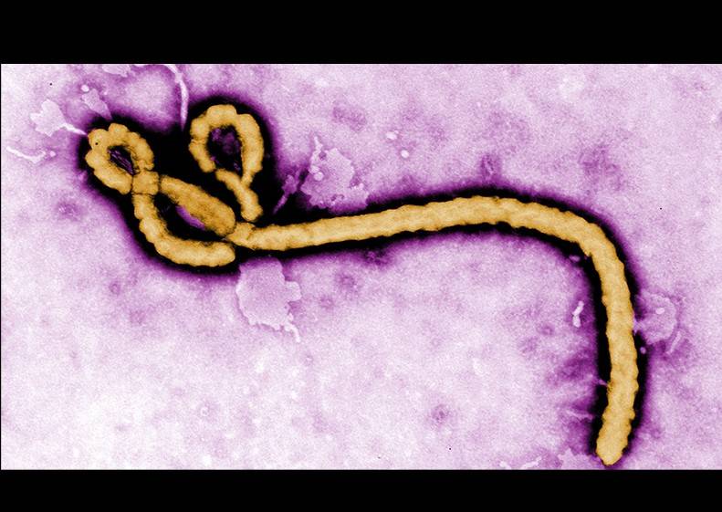 Ebola virus photo